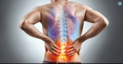 Spinal Fusion Surgeries: Can Pedicle Screw Breach Cause Neurological Damage?